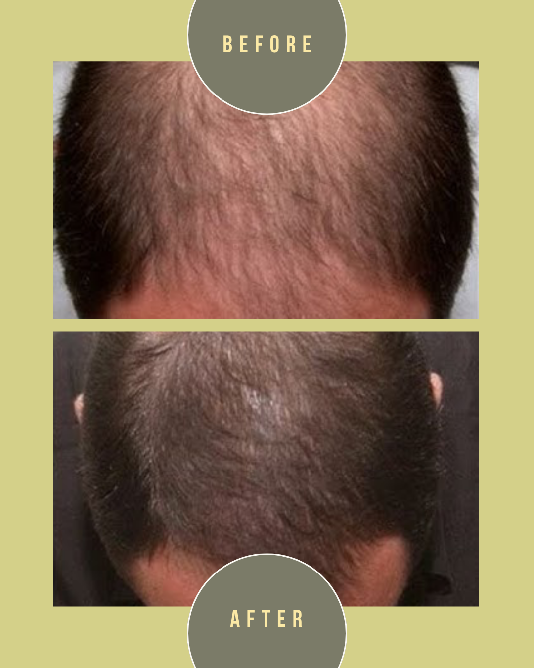ENVYLOCKS Natural Hair Oil